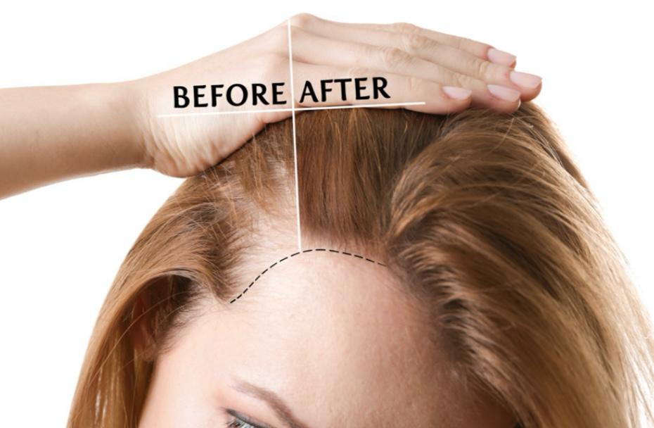 DEEP ADVANCED HAIR TREATMENT